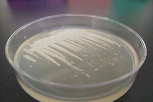 寒天培地上でコロニーを形成するプロトテカ（Prototheca cutis JCM 15793）。（画像：筑波大学発表資料より）