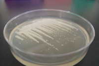 寒天培地上でコロニーを形成するプロトテカ（Prototheca cutis JCM 15793）。（画像：筑波大学発表資料より）