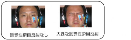 図1：聴覚性瞬目反射の実際（写真：NCNPの発表資料より）