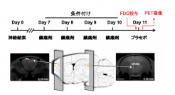 プラセボ効果に関わる脳領域。（画像:理化学研究所発表資料より）