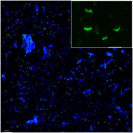 タカサゴシロアリの腸内でキシラナーゼを生産する共生細菌（緑）の分布の様子。青い大きな塊は木片の自家蛍光。右上の差込み画像は、共生細菌の拡大蛍光顕微鏡画像。スケールバーは 10μm。（撮影:松浦優氏）
