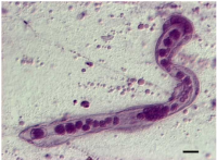 30個の細胞しかもたない寄生虫のニハイチュウ（写真：阪大の発表資料より）