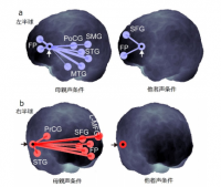 母親声条件と他者声条件における左下前頭回（a 白矢印）、右上側頭回（b 黒矢印）との脳機能結合。（画像:慶應義塾大学発表資料より）