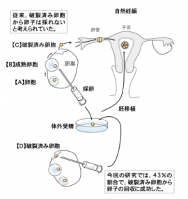 確率 体外 受精