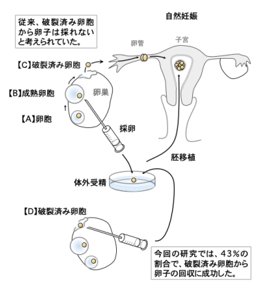 千葉大ら 排卵済みの卵胞から高確率で卵子を回収 体外受精に成功 財経新聞