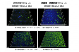単核球投与後の脳内の血管新生増加と神経軸索伸展。(画像:新潟大学発表資料より) 単核球投与後の脳内の血管新生増加と神経軸索伸展。(画像:新潟大学発表資料より)