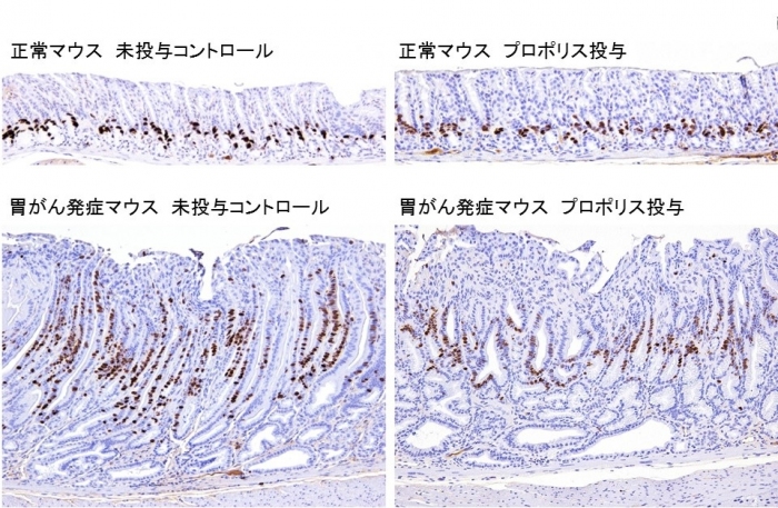 胃の組織像。疾患モデル動物A4gnt KOマウスに自然発症した分化型胃癌における細胞増殖（核が茶色に染まっている）は、プロポリス投与により有意に減少した。