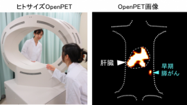 64Cu-セツキシマブ腹腔投与によるOpenPETのイメージ。左は、量研が開発したOpenPET(ヒトサイズ)。右は、64Cu-セツキシマブを腹腔投与し、OpenPETで撮像したマウス膵臓内の3 mm大の早期膵がん。（画像: 量子科学技術研究開発機構の発表資料より）