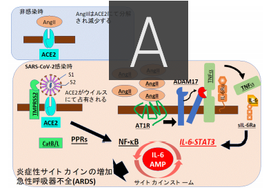 新型コロナウイルス感染後に重篤化するメカニズム（写真：北海道大学の発表資料より）