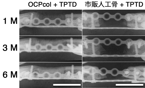 OCPcolとテリパラチドと組み合わせた骨移植法と、市販人工骨とテリパラチドを組み合わせた骨移植法を比較したレントゲン写真（東北大学の発表より）
