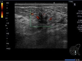 東大などが「人工知能を用いた医療画像と診療情報の統合による高精度な疾患画像判別モデルの開発」を発表。AIを用いて超音波検査画像と診療情報を統合する疾患画像判別モデルを開発。 東大などが「人工知能を用いた医療画像と診療情報の統合による高精度な疾患画像判別モデルの開発」を発表。AIを用いて超音波検査画像と診療情報を統合する疾患画像判別モデルを開発。