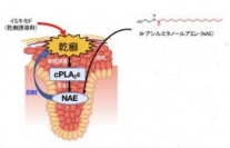 cPLA2εはNAE の産生を介して乾癬を抑える（画像: 東京大学の発表資料より）