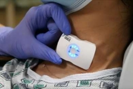 デンカが出資したカナダの医療機器新興Flosonics Medicalが開発しているパッチ型のワイヤレス・ウェアラブル超音波デバイス「FloPatch」。患者の首に貼り付けて血流をリアルタイムに測定できる。(写真:デンカの発表資料より) デンカが出資したカナダの医療機器新興Flosonics Medicalが開発しているパッチ型のワイヤレス・ウェアラブル超音波デバイス「FloPatch」。患者の首に貼り付けて血流をリアルタイムに測定できる。(写真:デンカの発表資料より)