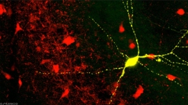 Shown in yellow, a parvalbumin interneuron in hippocampal (Sahay lab./Massgeneralbrigham.org)