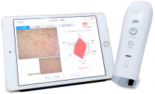 「Smart Skin Care」リニューアルのお知らせ　肌のアドバイス機能を搭載、使い勝手も大幅向上