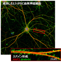記憶メカニズム研究や中枢神経系疾患の治療薬開発に有用なヒト神経細胞の作製に成功