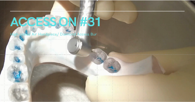 【DMM.make 3Dプリント×Dental Prediction】3Dプリントを用いた歯科施術のトレーニングサービスに関する業務提携開始