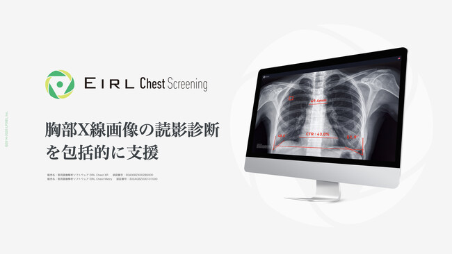 胸部X線画像の読影診断を支援するEIRL Chest Screeningの新モデルを発売、過去検出結果比較機能を追加し、比較読影支援を可能に