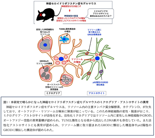 最新技術で中枢神経系細胞の異常な超微形態変化が明らかに