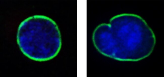 豆乳発酵液が細胞の核ラミナを正常化させることを発見