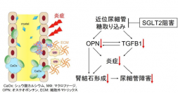 医療ビッグデータ活用した阿南氏らの尿路結石症治療の研究　日本尿路結石症学会賞を受賞