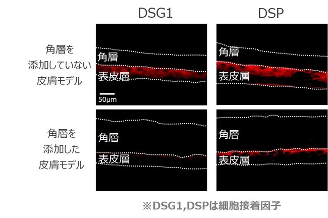 老化角質が生きている表皮細胞に与える悪影響を発見