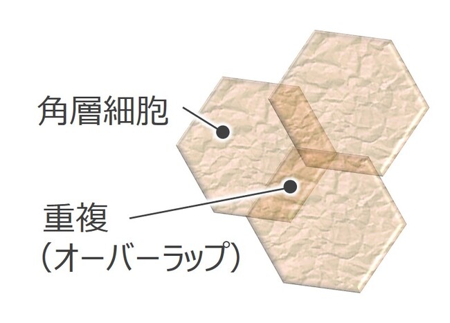 高齢者の角層がターンオーバーしづらい原因を発見