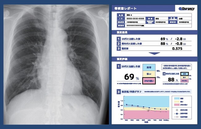 富士通とiSurgery、東京慈恵会医科大学整形外科学講座と骨の健康増進プロジェクトを開始