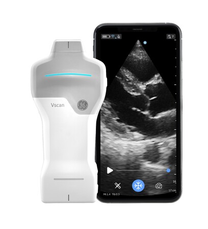 GEヘルスケア・ジャパン、循環器検査にも対応するポケットエコーVscan Air SLを発売