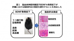脳が不調のとき肝臓も同時に不調になりうることを発見。--神経栄養因子BDNFモデルマウスを用いた