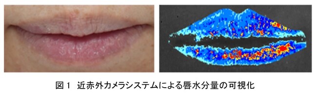 資生堂、唇表面における水分量の可視化・定量化に成功　～高いスキンケア効果を併せ持つ口紅など高付加価値の提供を実現する技術～