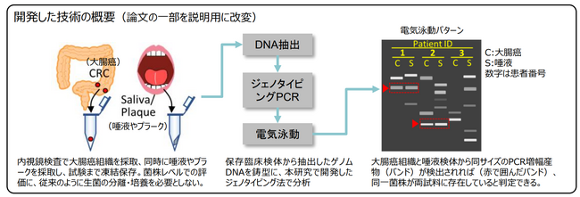 大腸癌組織や唾液検体中のフソバクテリウム・ヌクレアタム（Fn）を菌株レベルで検出する手法を開発