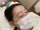 「眼精疲労」にスポット鍼 「眼精疲労」にスポット鍼