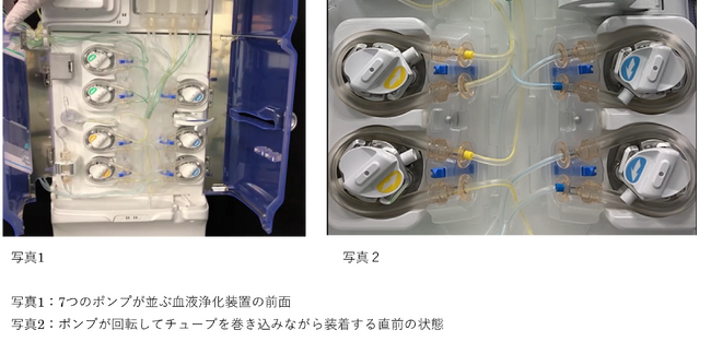 日機装、中部地方発明表彰「金沢市長賞」を受賞　血液浄化装置の準備で時短、治療をより迅速・確実に