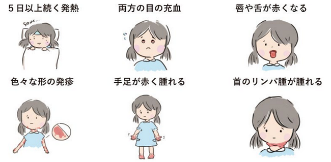川崎病の特定臨床研究の参加者を募集