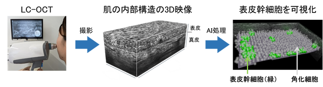 個々の肌の再生能力を予測するシステムを開発！