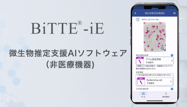 カーブジェン、微生物推定支援AIソフトウェア（非医療機器）「BiTTE(R)-iE」 サービス提供開始