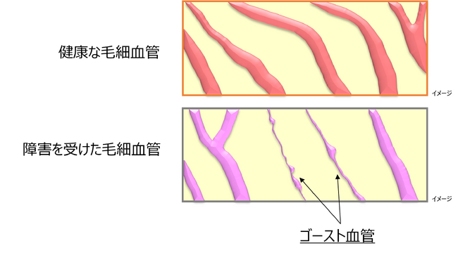 Tie2活性化による「ゴースト血管」対策に関する特許が令和5年度中国地方発明表彰で広島県知事賞を受賞