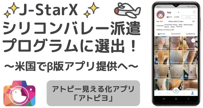 日本最大級のアトピー患者向けアプリ「アトピヨ」がJ-StarX起業家イベント参加型シリコンバレー派遣プログラムに選出！ ～2024年1月から米国でβ版アプリ提供へ～