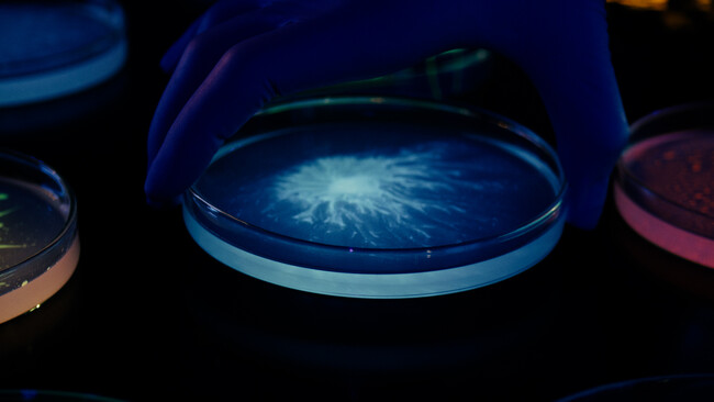 ロレアル、高精度プロバイオティクス研究の大手「ラクトビオ社」を買収