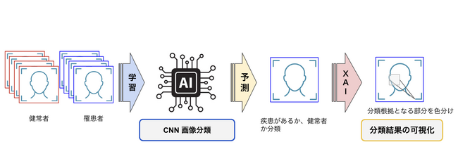 VAREALと埼玉医科大学がAIを用いた膠原病診断補助ツールの共同研究開発を実施