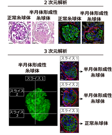 腎臓を透明にして3次元で糸球体の異常を診断 ―組織透明化技術で正確に病変を検出！―