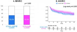 ECMOを要する心原性ショック患者の院内死亡は、新規補助装置で改善せず