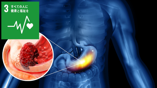 胃がん腹膜播種を促進する中皮細胞の新たな役割を解明
