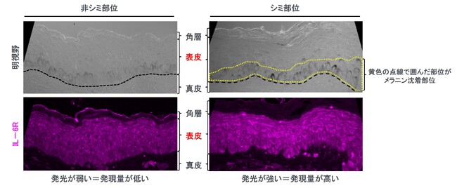 資生堂、加齢が日中の紫外線下でのシミリスクを増加させることを発見し、その抑制法を開発 ～シミ部位特有の慢性炎症の正体を解明し、紫外線と加齢の両方に対応～