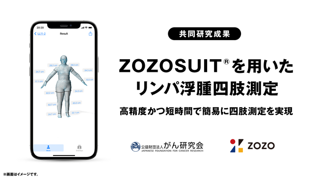 ZOZOSUIT(R)を用いたリンパ浮腫四肢測定