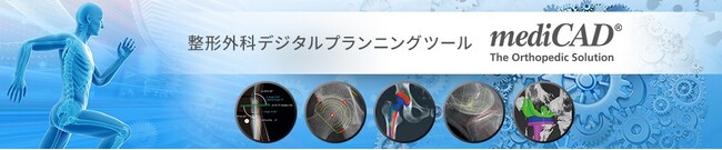 整形外科デジタルプランニングツール「mediCAD」導入200施設を突破