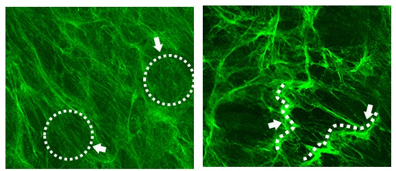 【ファンケル】紫外線によりコラーゲン線維の柔軟性が失われることを発見