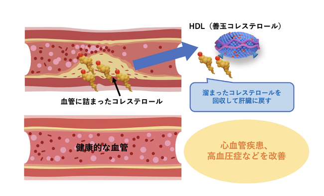 世界初・血管プラークからコレステロール回収能力向上する成分を立証