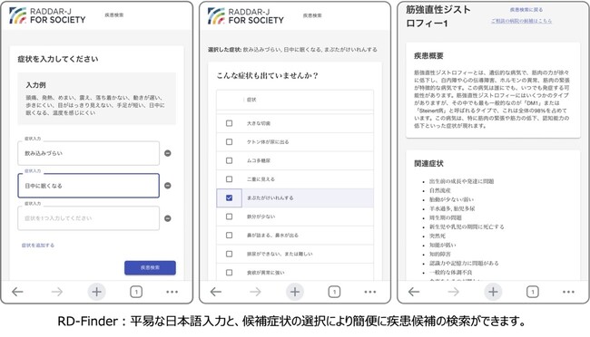 難病情報照会AIアプリケーションを開発しインターネット上で公開